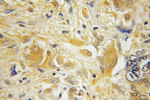 HPCAL4 Antibody in Immunohistochemistry (Paraffin) (IHC (P))