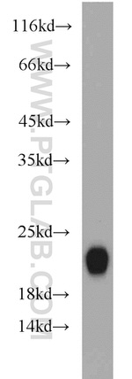 HPCAL4 Antibody in Western Blot (WB)