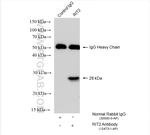 RIT2 Antibody in Immunoprecipitation (IP)