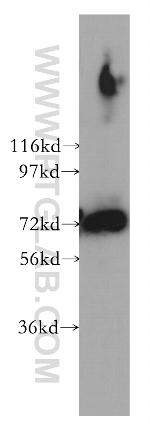 PREPL Antibody in Western Blot (WB)