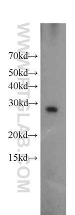 Ephrin A3 Antibody in Western Blot (WB)