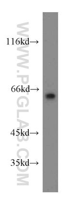 LGI1 Antibody in Western Blot (WB)