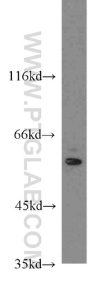 LGI1 Antibody in Western Blot (WB)