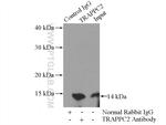 TRAPPC2 Antibody in Immunoprecipitation (IP)