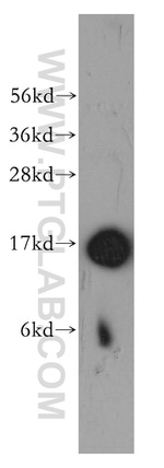 TRAPPC2 Antibody in Western Blot (WB)