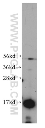 TRAPPC2 Antibody in Western Blot (WB)