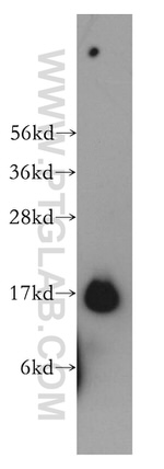 TRAPPC2 Antibody in Western Blot (WB)