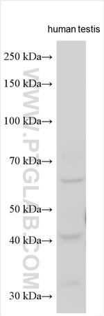 ACRBP Antibody in Western Blot (WB)