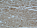 TBL2 Antibody in Immunohistochemistry (Paraffin) (IHC (P))