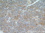 TBL2 Antibody in Immunohistochemistry (Paraffin) (IHC (P))