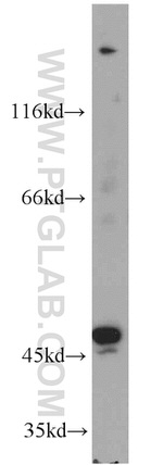 TBL2 Antibody in Western Blot (WB)