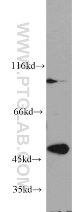 TBL2 Antibody in Western Blot (WB)