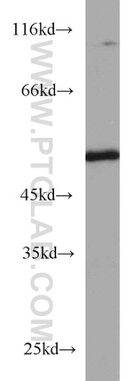 TBL2 Antibody in Western Blot (WB)