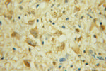 CRTC2/TORC2 Antibody in Immunohistochemistry (Paraffin) (IHC (P))