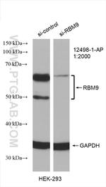FOX2/RBM9 Antibody in Western Blot (WB)
