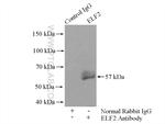 ELF2 Antibody in Immunoprecipitation (IP)