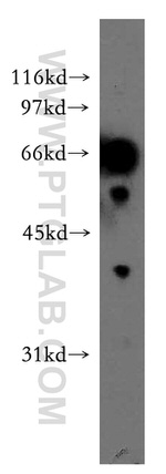 ELF2 Antibody in Western Blot (WB)