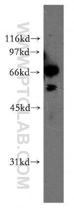 ELF2 Antibody in Western Blot (WB)