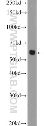 CHST1 Antibody in Western Blot (WB)