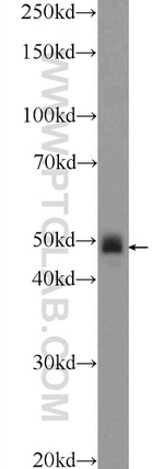 CHST1 Antibody in Western Blot (WB)