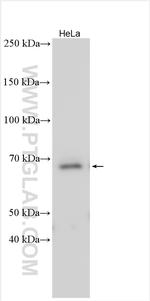 Collagen Type IX Antibody in Western Blot (WB)