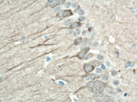 AK5 Antibody in Immunohistochemistry (Paraffin) (IHC (P))