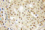 SFRS14 Antibody in Immunohistochemistry (Paraffin) (IHC (P))