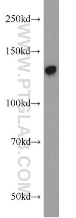 SFRS14 Antibody in Western Blot (WB)