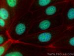 ZBTB32 Antibody in Immunocytochemistry (ICC/IF)