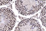 ZBTB32 Antibody in Immunohistochemistry (Paraffin) (IHC (P))