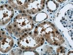 TRUB1 Antibody in Immunohistochemistry (Paraffin) (IHC (P))
