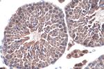 TRUB1 Antibody in Immunohistochemistry (Paraffin) (IHC (P))