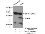 TRUB1 Antibody in Immunoprecipitation (IP)