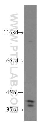 TRUB1 Antibody in Western Blot (WB)