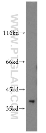 TRUB1 Antibody in Western Blot (WB)