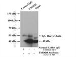 TMOD3 Antibody in Immunoprecipitation (IP)