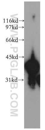 TMOD3 Antibody in Western Blot (WB)