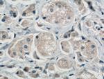 SULT1E1 Antibody in Immunohistochemistry (Paraffin) (IHC (P))