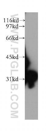 SULT1E1 Antibody in Western Blot (WB)