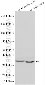 ANKRA2 Antibody in Western Blot (WB)