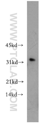 CHMP2B Antibody in Western Blot (WB)