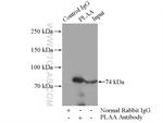 PLAA Antibody in Immunoprecipitation (IP)