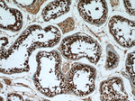 GAGE2D Antibody in Immunohistochemistry (Paraffin) (IHC (P))