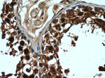 GAGE2D Antibody in Immunohistochemistry (Paraffin) (IHC (P))