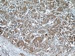 GAGE2D Antibody in Immunohistochemistry (Paraffin) (IHC (P))