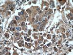 GAGE2D Antibody in Immunohistochemistry (Paraffin) (IHC (P))