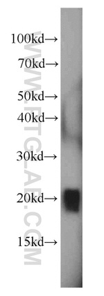 GAGE2D Antibody in Western Blot (WB)