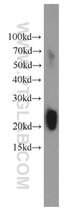 GAGE2D Antibody in Western Blot (WB)