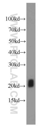 GAGE2D Antibody in Western Blot (WB)