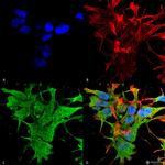 Dicer Antibody in Immunocytochemistry (ICC/IF)